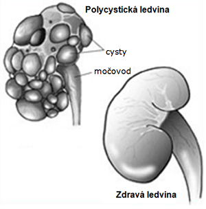 Polycystická choroba ledvin u koček, PKD